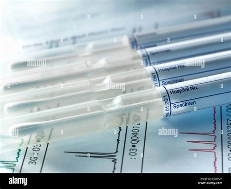 Prueba De Paternidad Marcadores Muestras Lupon Gov Ph