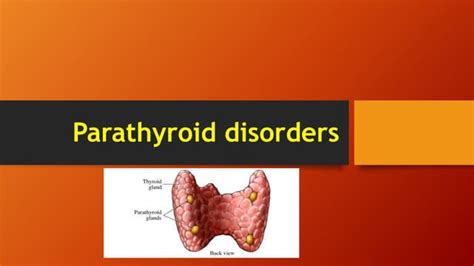 parathyroid gland disorders final.pptx