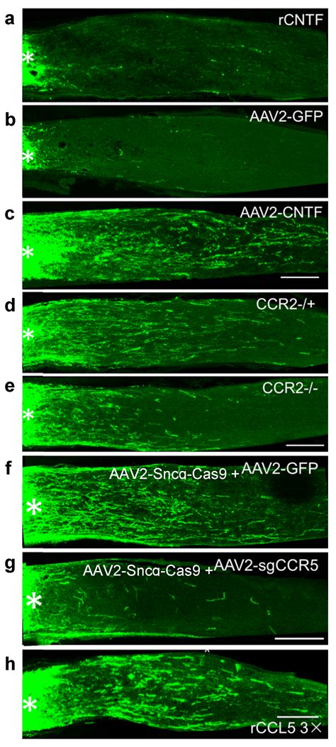 Ijms Free Full Text Retinal Ganglion Cell Survival And Axon