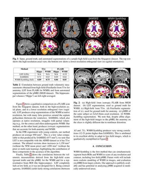 Quantifying White Matter Hyperintensity And Brain Volumes In