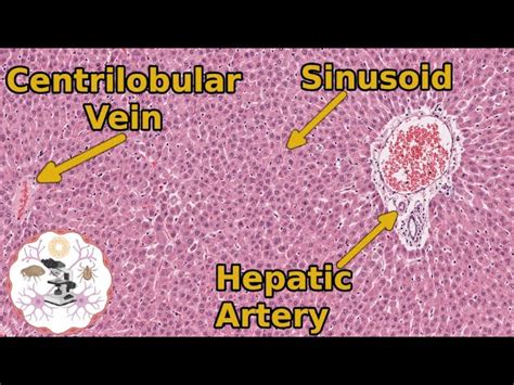 Liver Histology Sinusoids