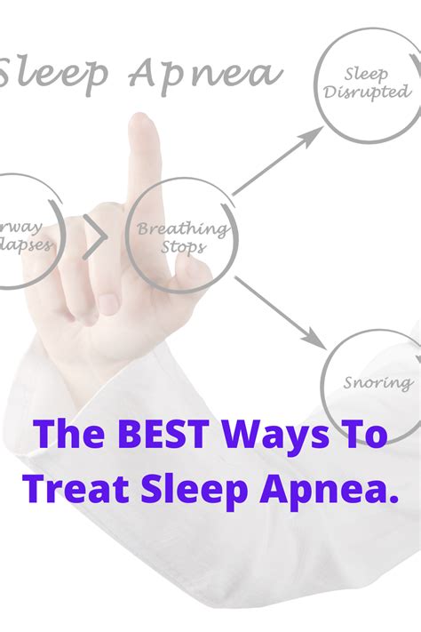 The Best Ways To Treat Sleep Apnea In 2021 Sleep Apnea Apnea