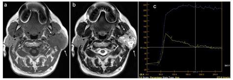 Cancers Free Full Text The Value Of Multiparametric Magnetic