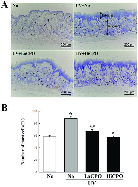 Number of mast cells into photoaging skin. Numbers of mast cells in ...