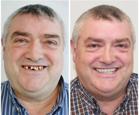 Teeth Transformation - Dental News Network