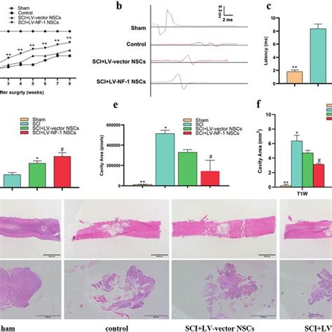 Transplantation Of Nf Knockout Neural Stem Cells Nscs Enhanced