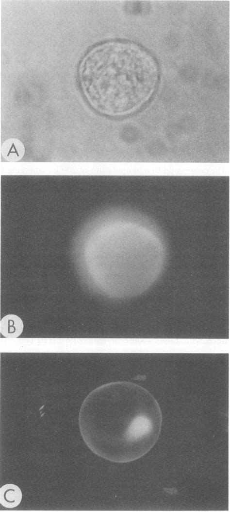 Light And Fluorescence Microscopy Of Encysting Cells Of E Histolytica Download Scientific