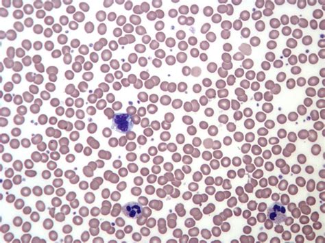 Introduction To Haematology Clinician Revision