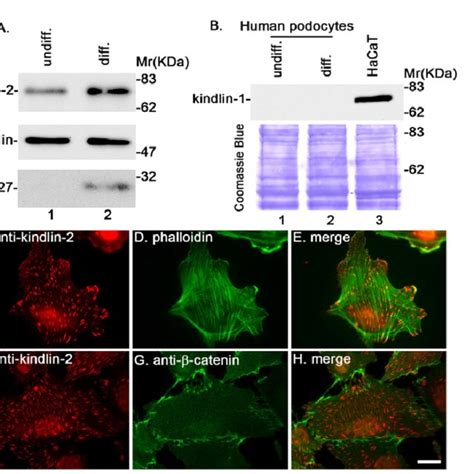 Knockdown Of Kindlin 2 Inhibits 1 And 3 Integrin Activation