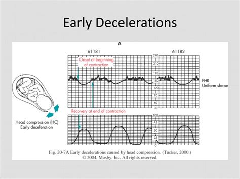 Ppt Fetal Assessment In Labor Powerpoint Presentation Free Download Id 2108127