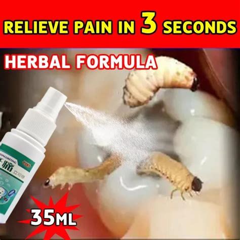 Toothache Oral Spray Toothache Reliever Toothache Pain Relief Teeth Care Sprays 35ml Prevent