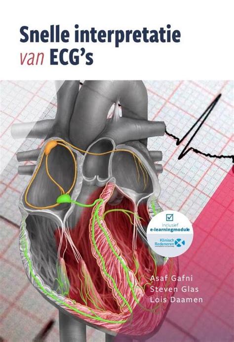 Snelle Interpretatie Van ECG S Boek 9789083139319 Bruna