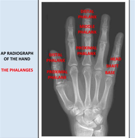 Finger Hand And Wrist Anatomy Flashcards Quizlet