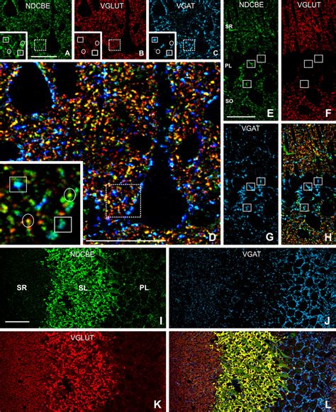 Triple Immunofluorescence For Ndcbe Green Vglut Red And Vgat