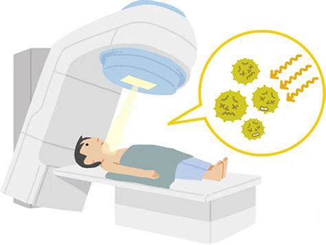 大腸がんの放射線療法とは？ 小野薬品 がん情報 一般向け