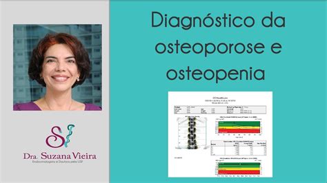 Diagnóstico da osteoporose e osteopenia YouTube