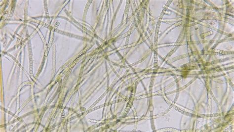 1,409 Cyanobacteria Microscope Royalty-Free Photos and Stock Images ...