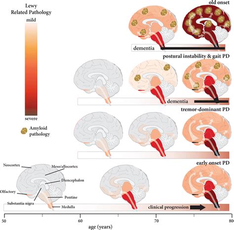 Neuropathology Underlying Clinical Variability In Patients With