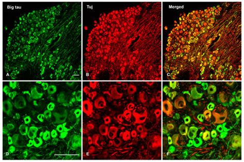 Cells Free Full Text Regulation Of Tau Expression In Superior