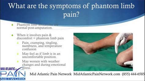 Basics Of Phantom Limb Pain Explained By Mid Atlantic Pain Network 855