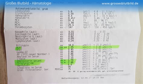 Kleines Blutbild Tabelle Der Werte Für Erwachsene Einfach Erklärt