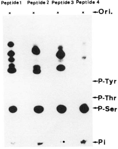 Figure 2 From Protein Kinase C Phosphorylation Of Desmin At Four Serine