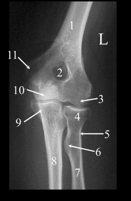 Ap Elbow Anatomy Diagram Quizlet