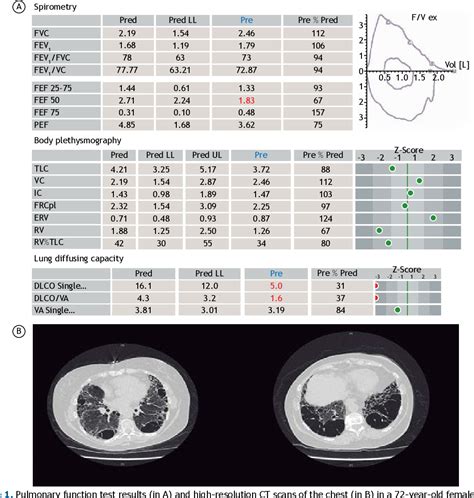 Figure From Why We Should Never Ignore An Isolated Low Lung