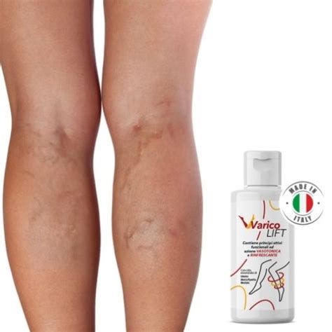 Varicolift Crema Per Vene Varicose Recensioni Opinioni E Prezzo