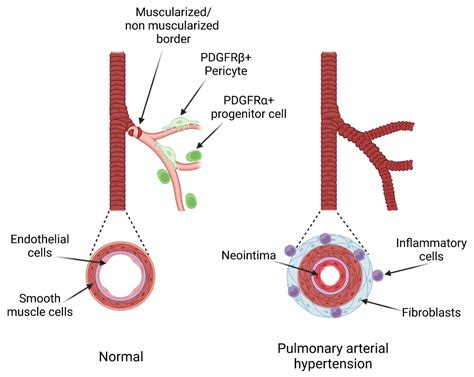 Life Free Full Text The Platelet Derived Growth Factor Pathway In