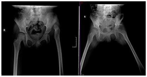 Medicina Free Full Text Current Evidence About Developmental