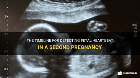 The Timeline For Detecting Fetal Heartbeat In A Second Pregnancy