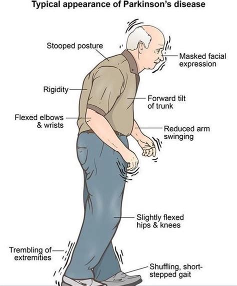 Visual Examination Of A Joint Medical Term Patience Has Barnett