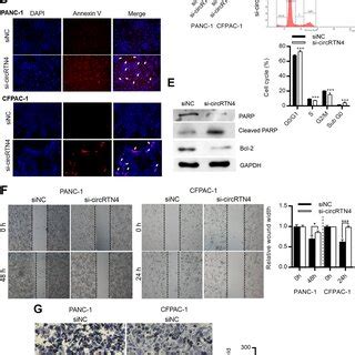 Circrtn Is Upregulated In Pdac Cells And Primary Tumors And Associates