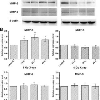 Effects Of X Ray Irradiation On MMP 2 And MMP 9 Expression A Western