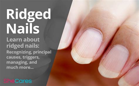 Ridge Nails Shecares