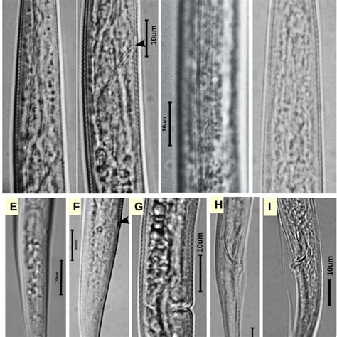 Photomicrographs Of Ditylenchus Rafiqi N Sp A Female Anterior End