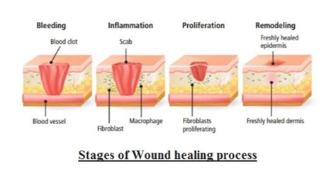 Answered: Describe the process of tissue or wound… | bartleby