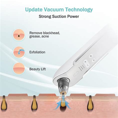 2023 EZBASICS Rechargeable Blackhead Remover Vacuum | 3 Adjustable
