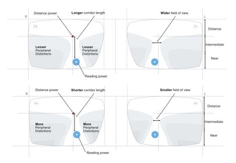 Standard Vs Customized Progressive Lenses Evershine Optical