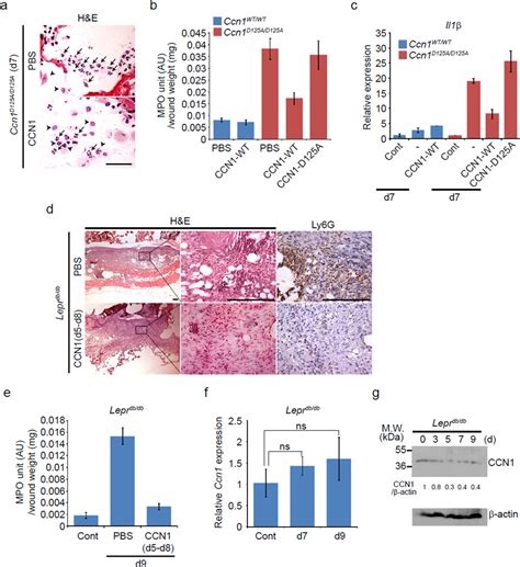 The Matricellular Protein CCN1 Mediates Neutrophil Efferocytosis In