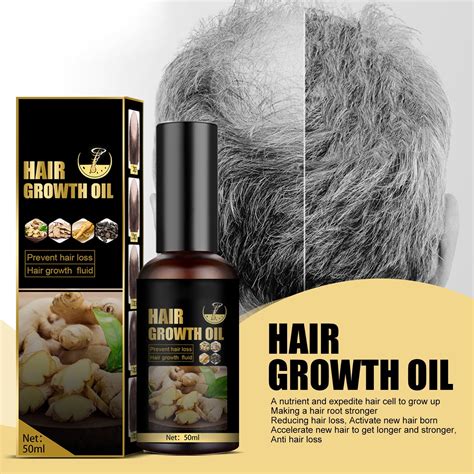 Garenas Anti Falling Hair Spray Anti Hair Loss Hair Liquid Hair Growth Agent Nutrient Serum