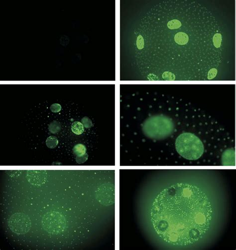 Fluorescence Microscopy Visualization Of Ros During The Sex Inducing