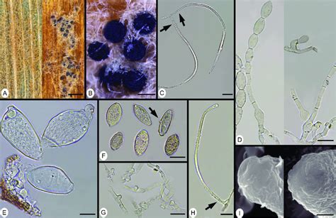 Blumeria Graminis S Str A Infected Leaf Surface With Primary Mycelia Download Scientific