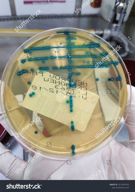 Enterococcus Faecalis Urine Culture On Chromogenic Stock Photo