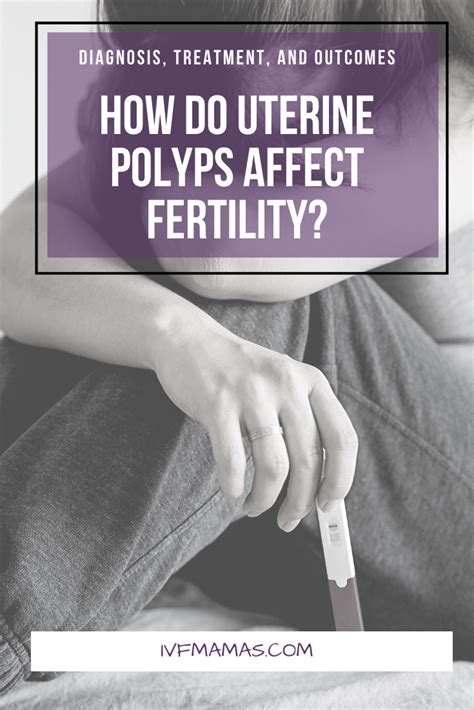 Infertility And Uterine Polyps Diagnosis And Outcomes In 2020