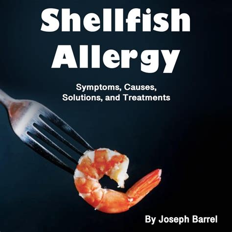 Shellfish Allergy: Symptoms, Causes, Solutions, and Treatments - Ljudbok - Joseph Barrel - Storytel