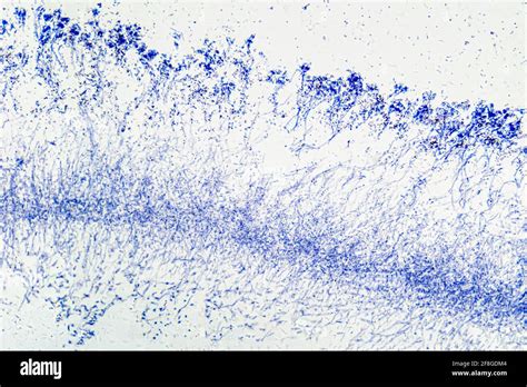 Penicillium Hongos Ascomicetos Bajo Un Microscopio El Micelium La