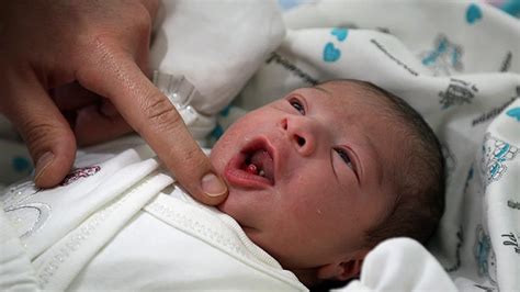 Baby Born With All Teeth