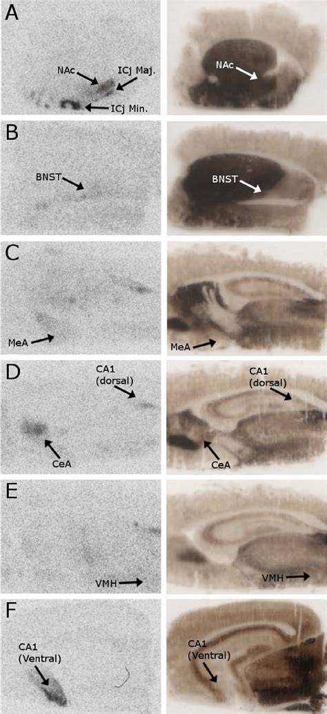 Coronal Hemi Sections Showing Regions Of Oxytocin Receptor Binding In